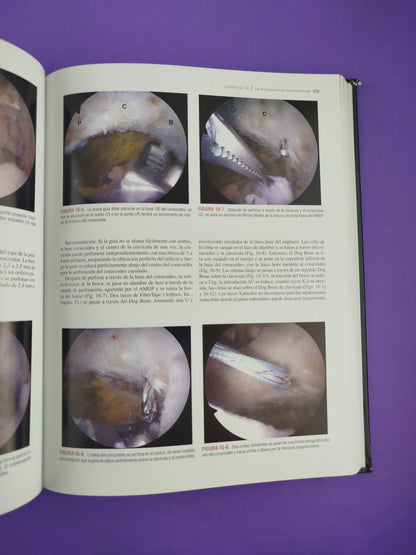 Artroscopia del hombro tercera edición