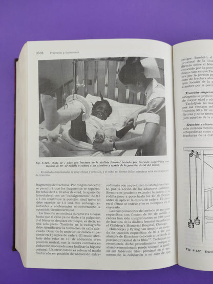 Ortopedia pediátrica segunda edición 4 tomos