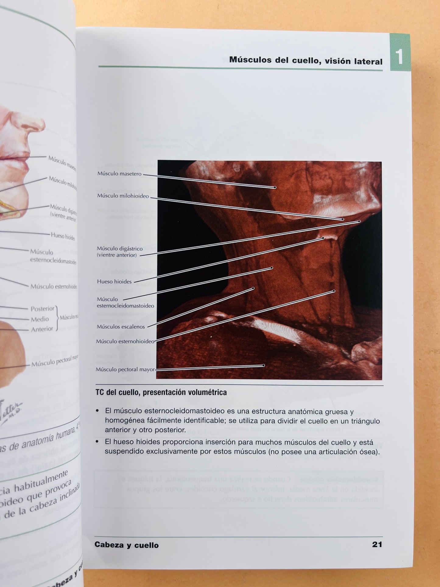 Netter anatomía radiológica esencial
