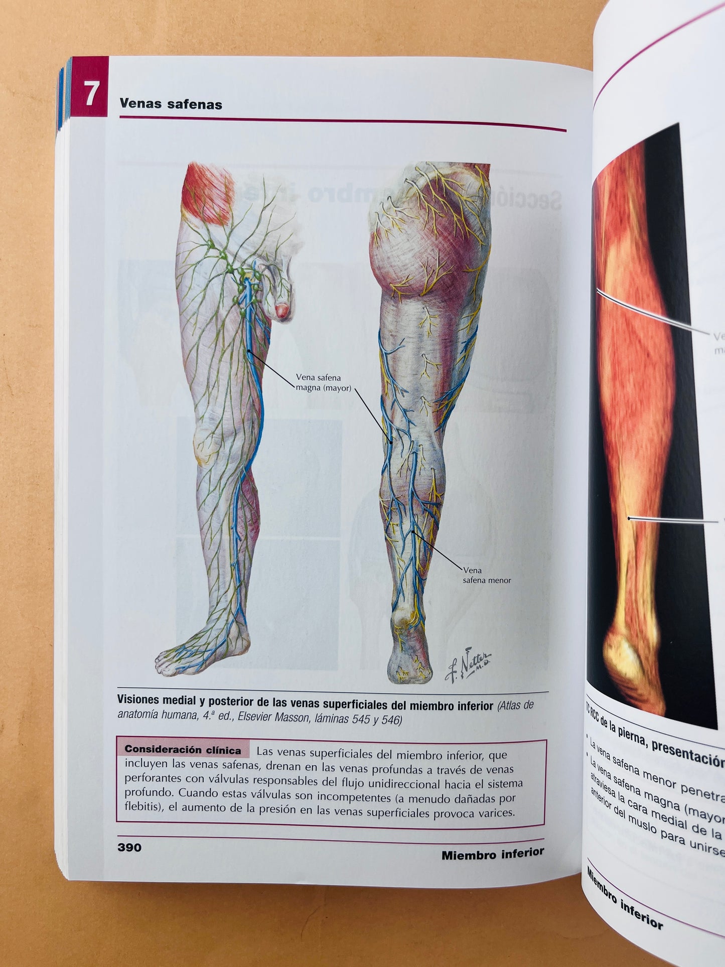 Netter anatomía radiológica esencial