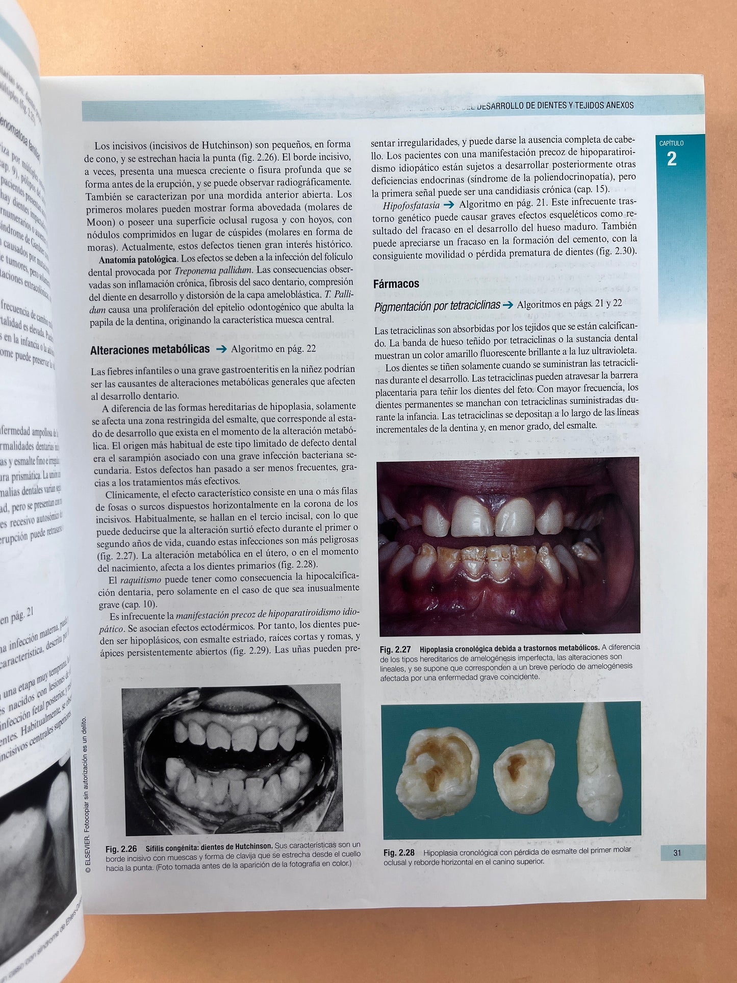 Cawson Fundamentos de Medicina y Patología Oral octava edición