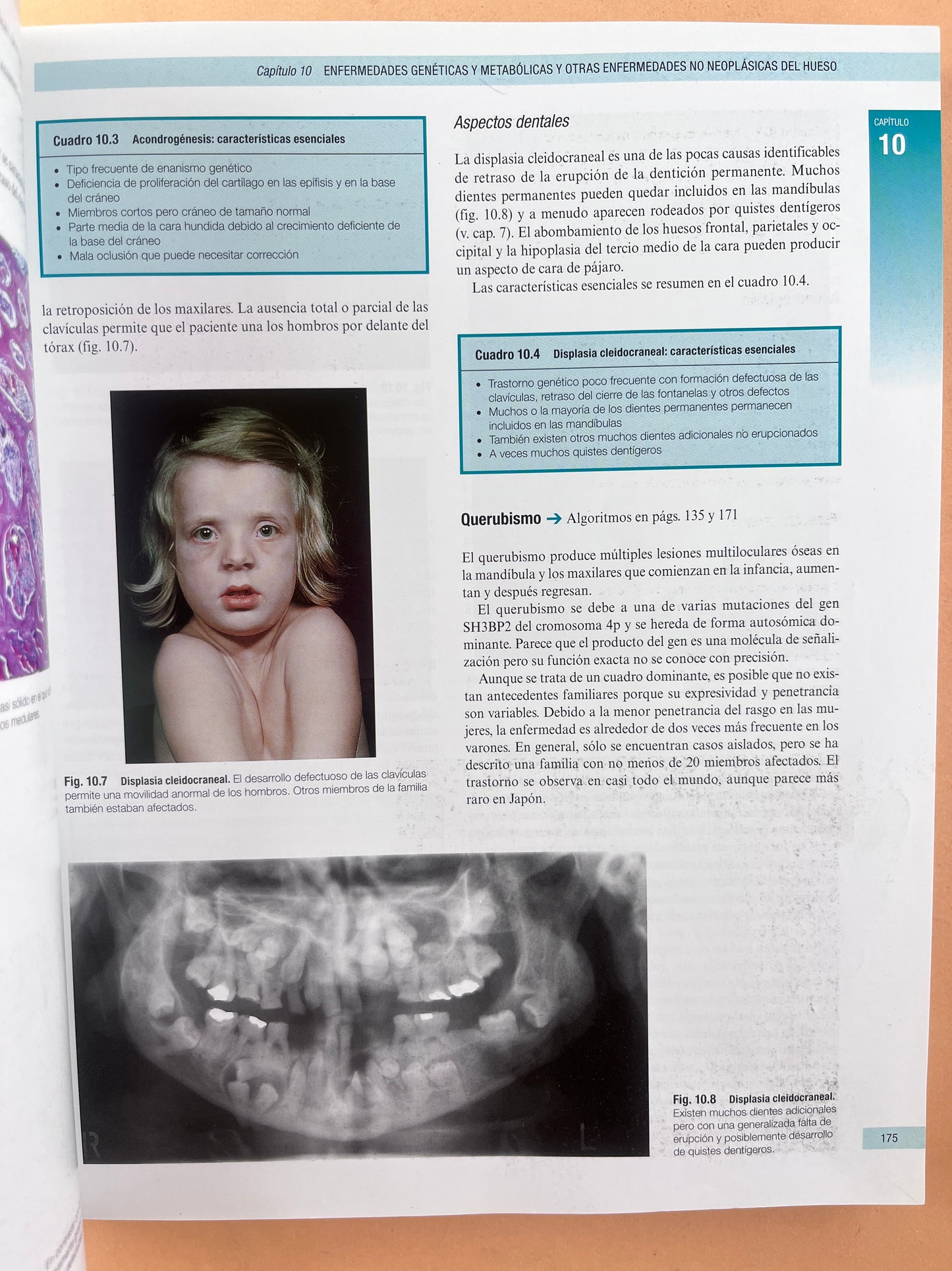 Cawson Fundamentos de Medicina y Patología Oral octava edición