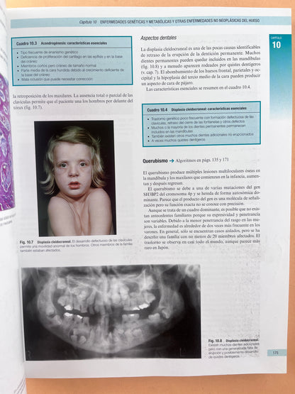 Cawson Fundamentos de Medicina y Patología Oral octava edición