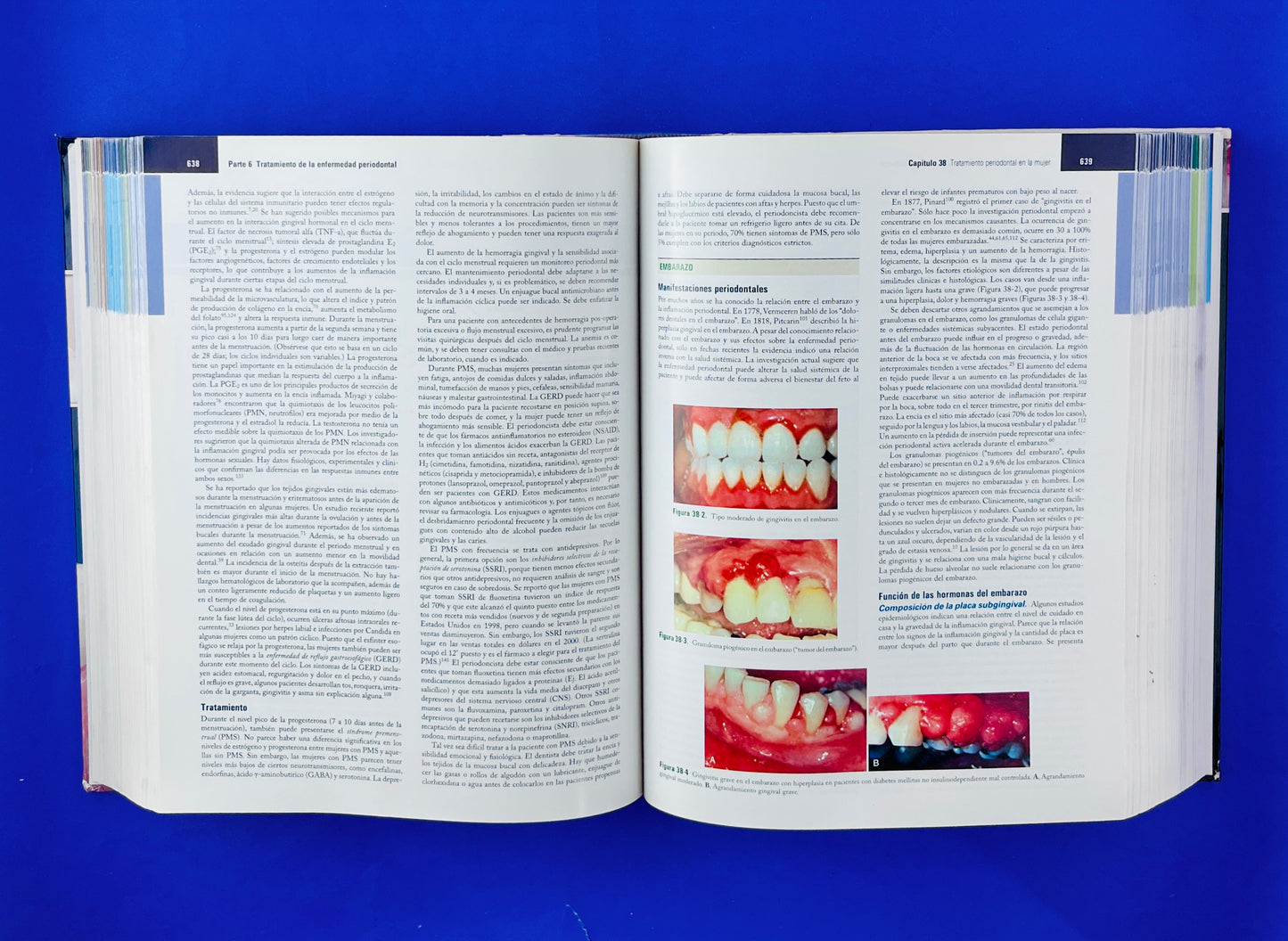 Periodontología Clínica de Carranza onceava edición