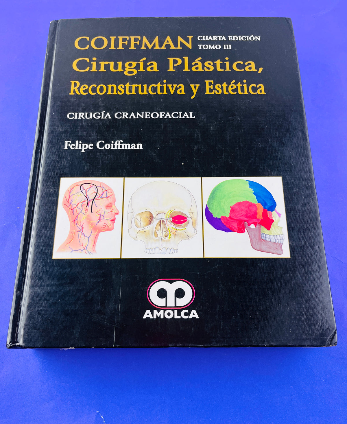 Cirugía plástica, reconstructiva y estética cirugía craneofacial cuarta edición tomo III by Felipe Coiffman