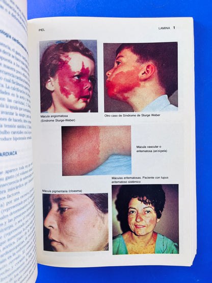 Semiología médica cuarta edición