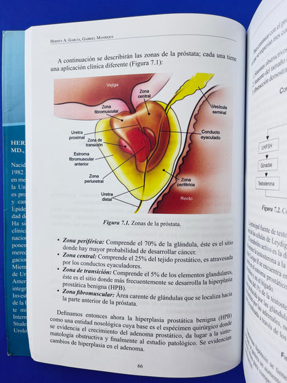 Urología en pocas palabras un enfoque práctico para el médico general