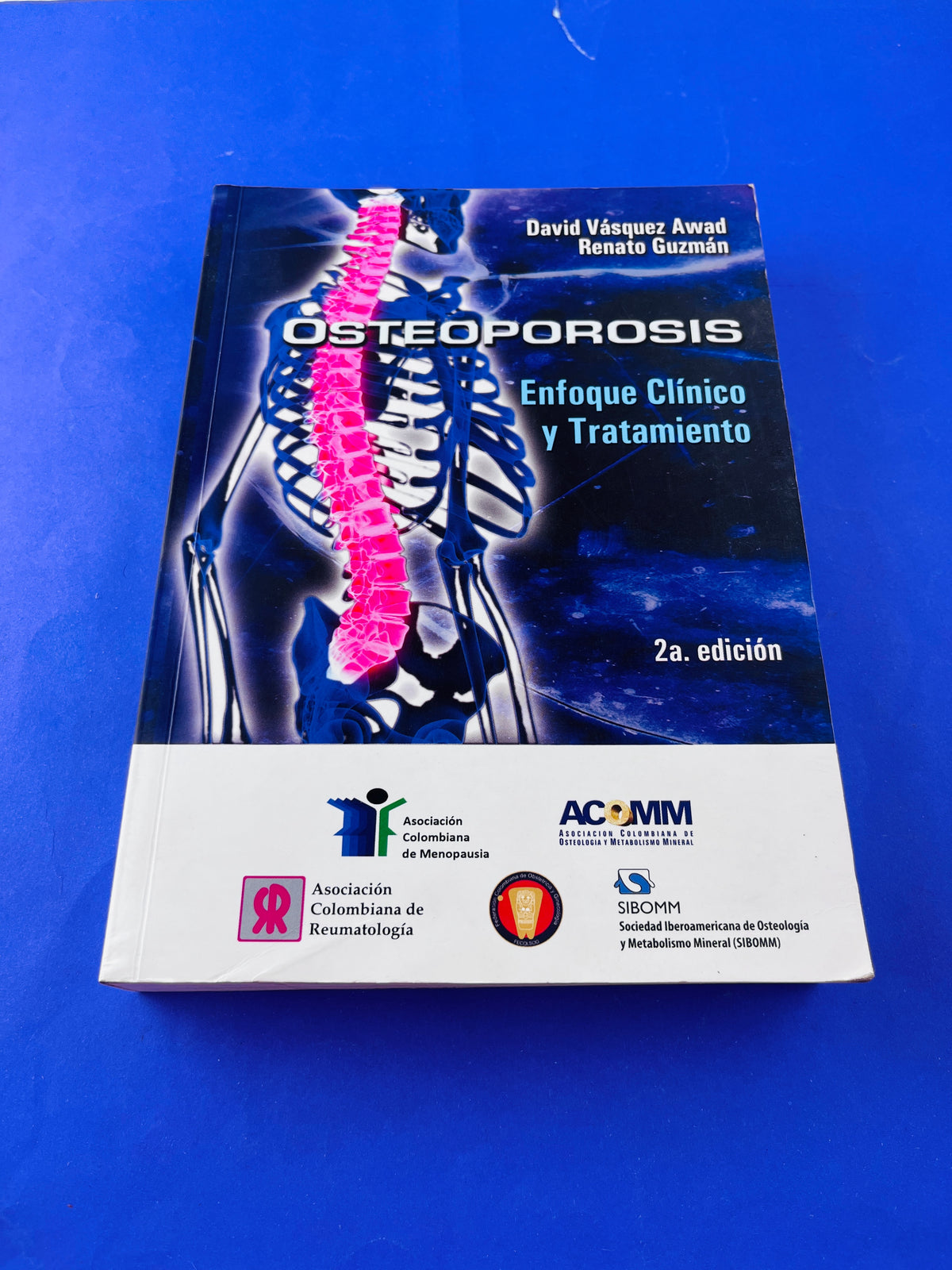 Osteoporosis enfoque clínico y tratamiento segunda edición by David Vasquez Awad Renato Guzmán