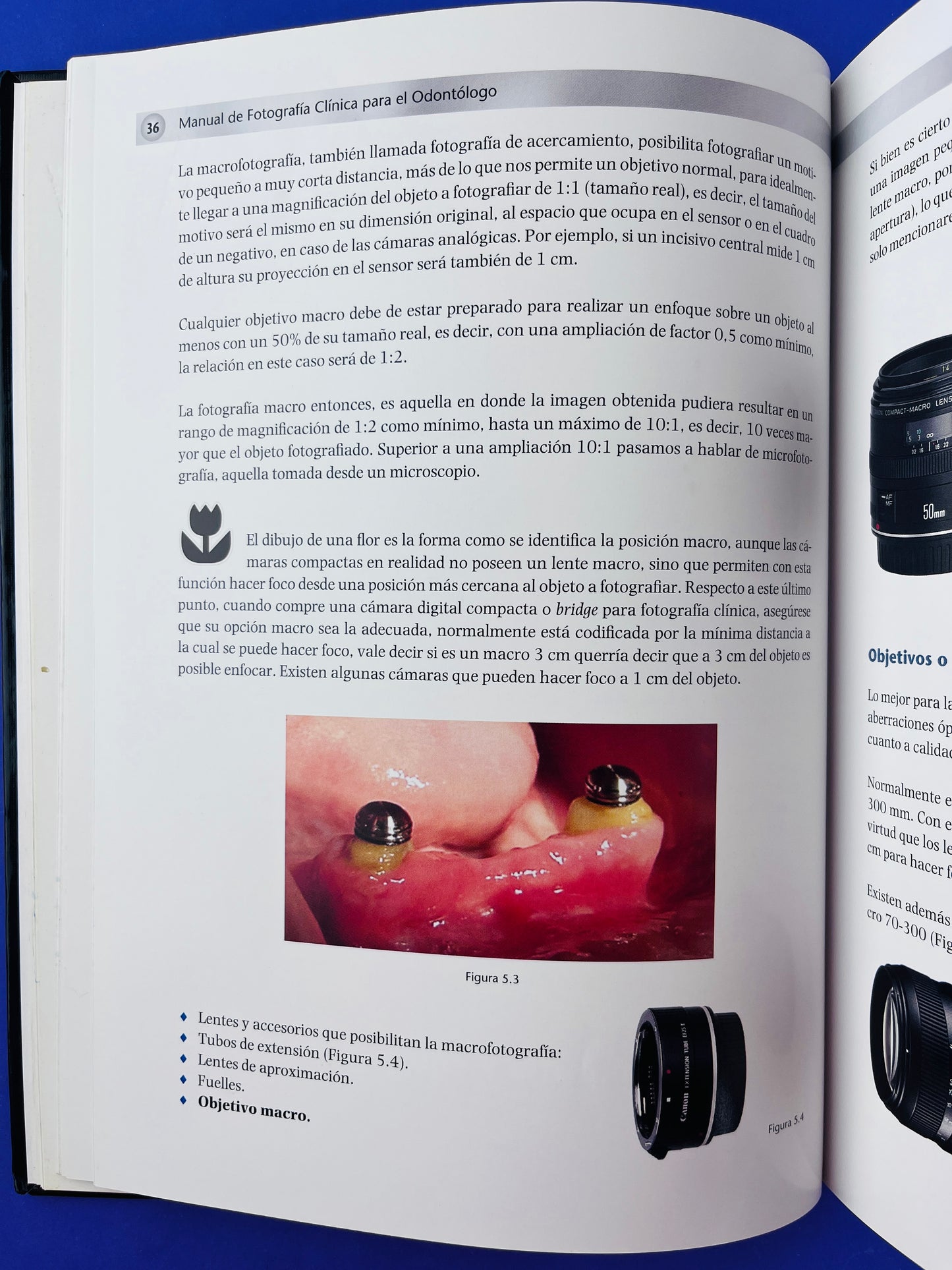Manual de fotografía clínica para el Odontólogo