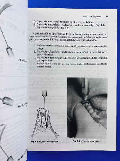 Manual de anestesia odontológica