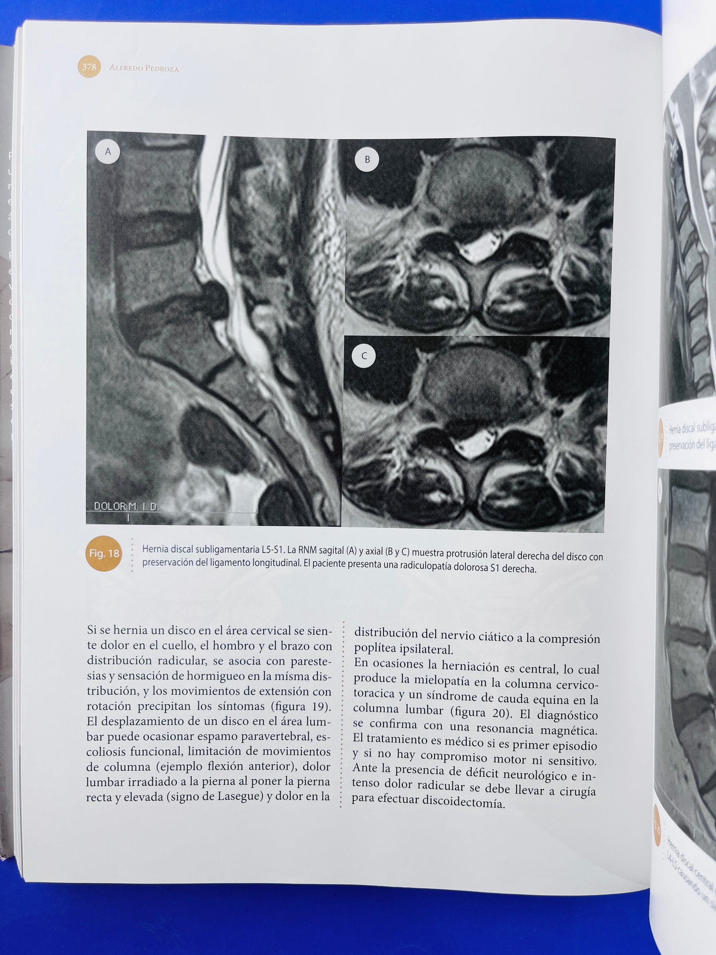 Sistema nervioso Neuroanatomía funcional y clínica