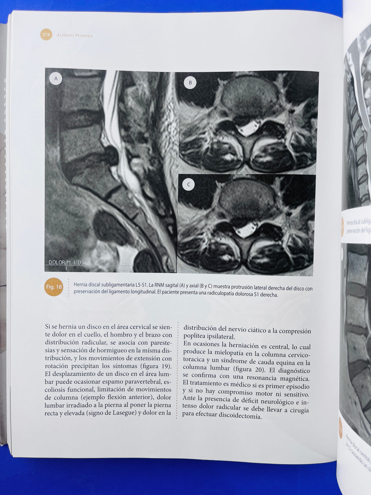 Sistema nervioso Neuroanatomía funcional y clínica by Martha I Escobar