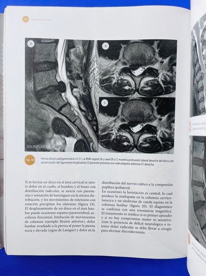 Sistema nervioso Neuroanatomía funcional y clínica