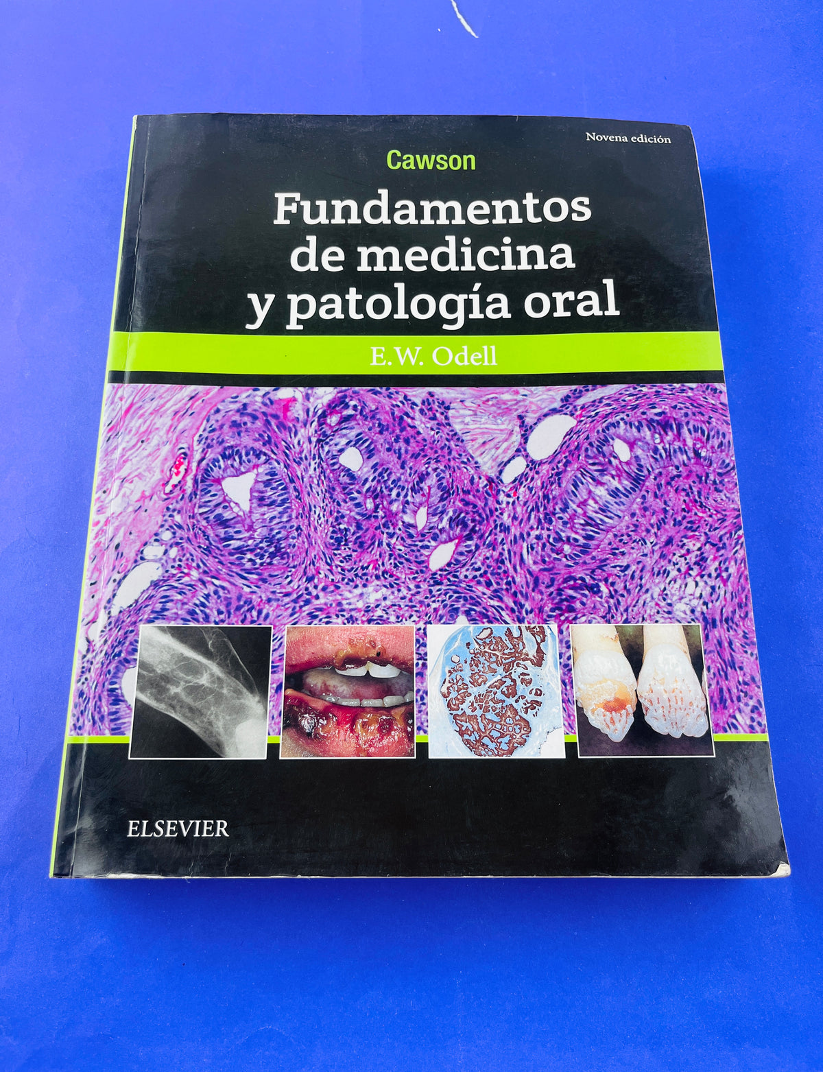 Cawson Fundamentos de Medicina y Patología Oral novena edición by E.W. Odell