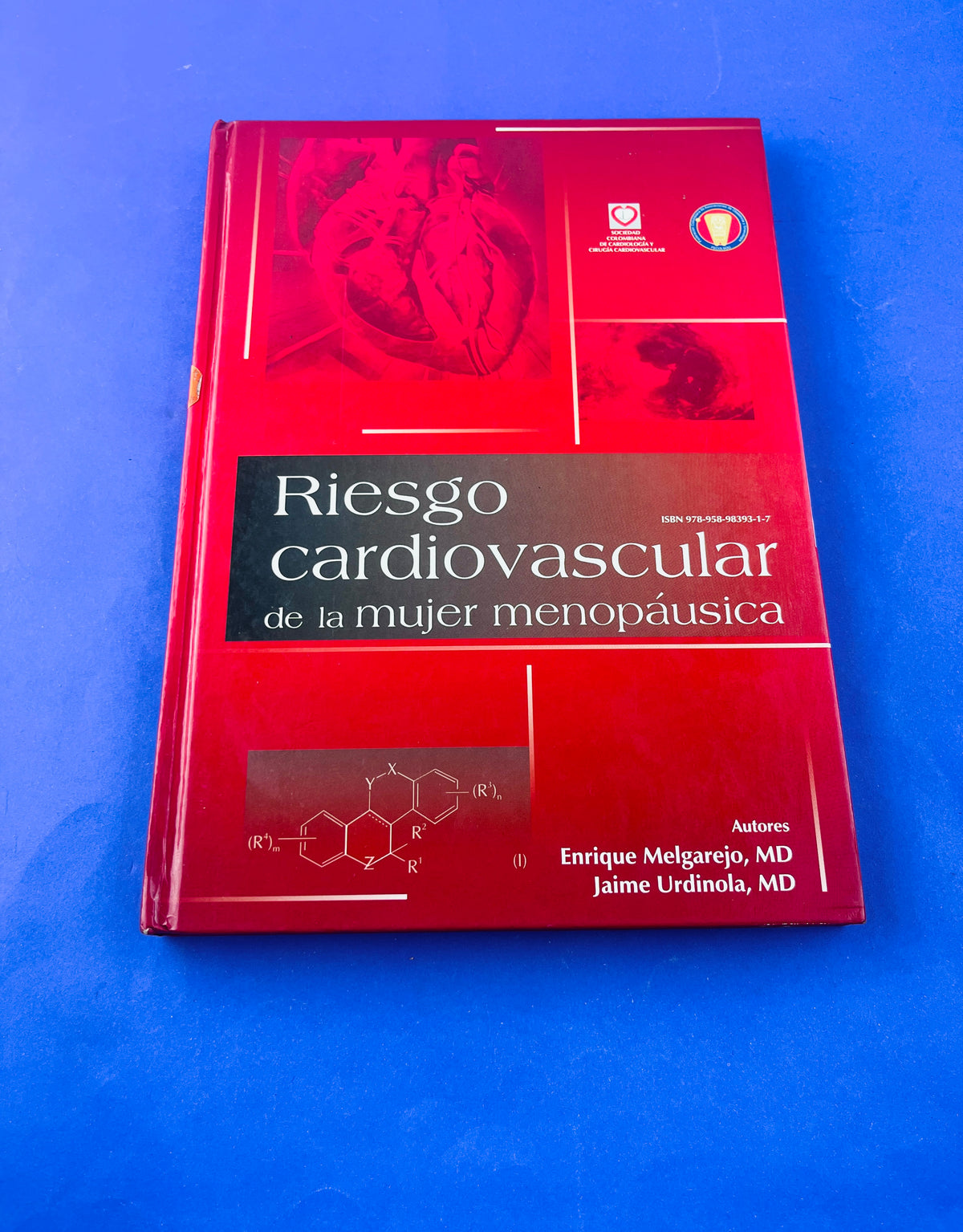 Riesgo cardiovascular de la mujer menopáusica by Enrique Melgarejo Jaime Urdinola
