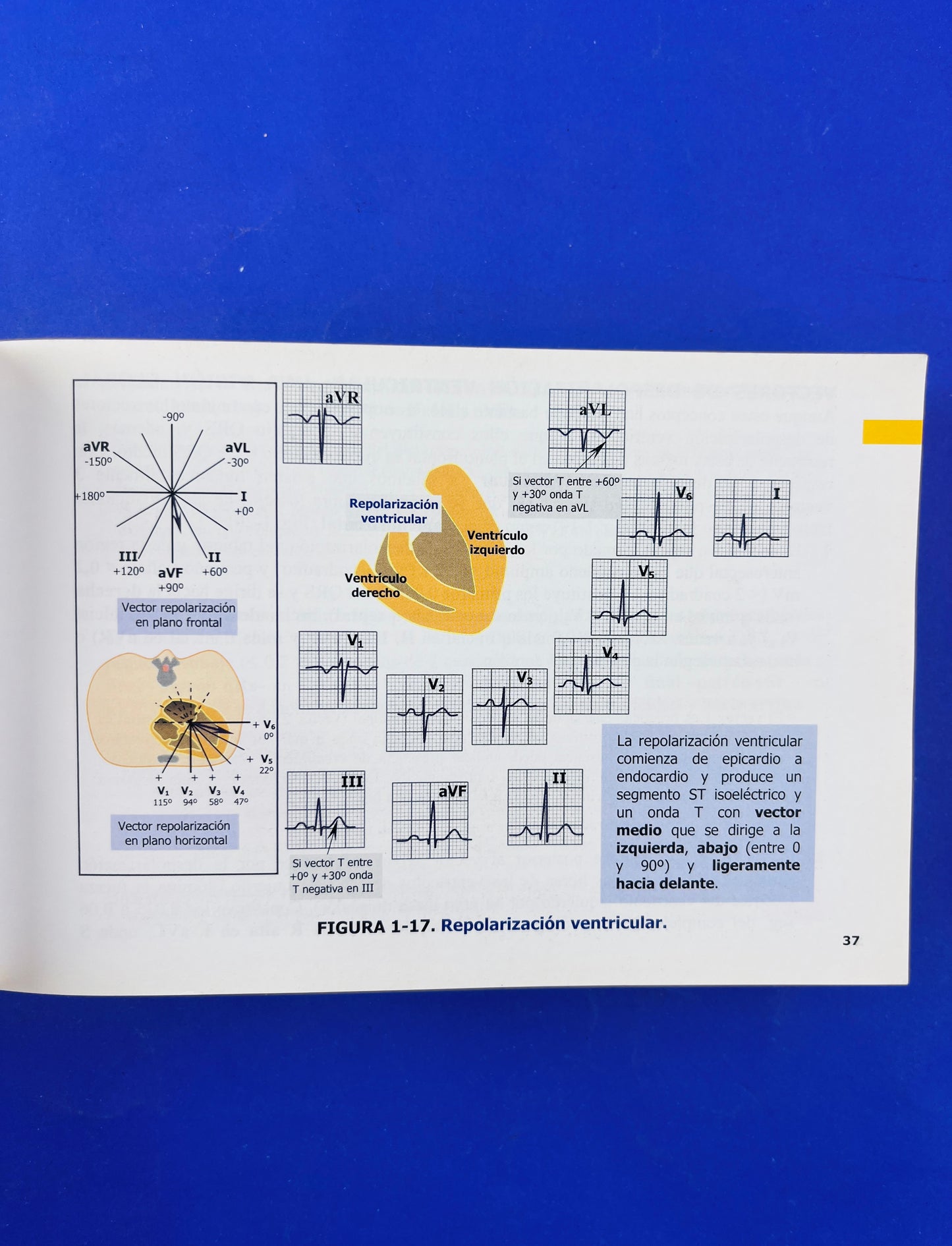 Pautas en eléctrocardiograma ECG