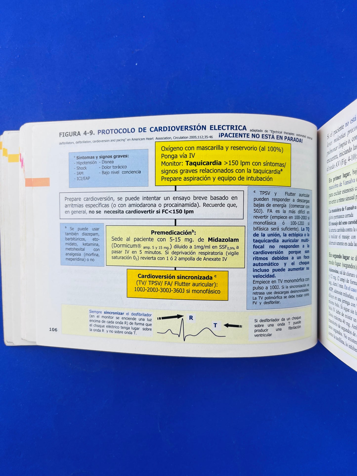 Pautas en eléctrocardiograma ECG