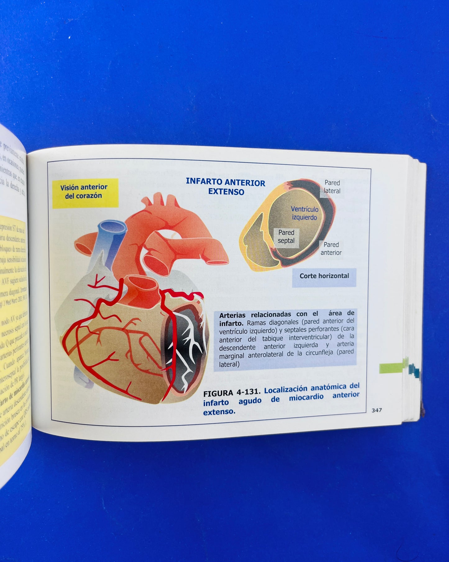 Pautas en eléctrocardiograma ECG