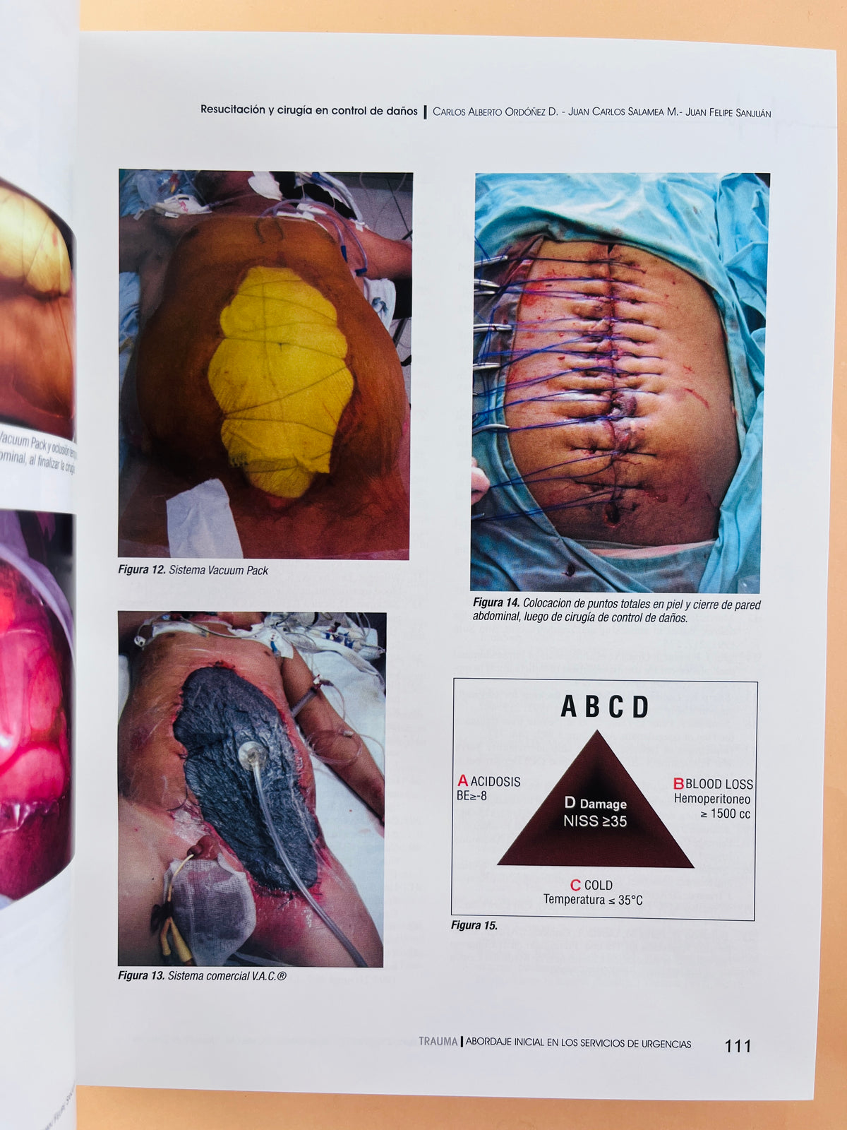 Trauma abordaje inicial en los servicios de urgencias quinta edición by Laureano Quintwero B.