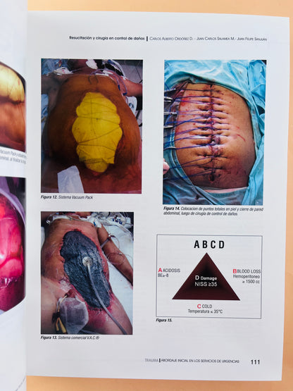 Trauma abordaje inicial en los servicios de urgencias quinta edición