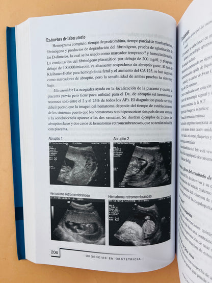 Urgencias en obstetricia