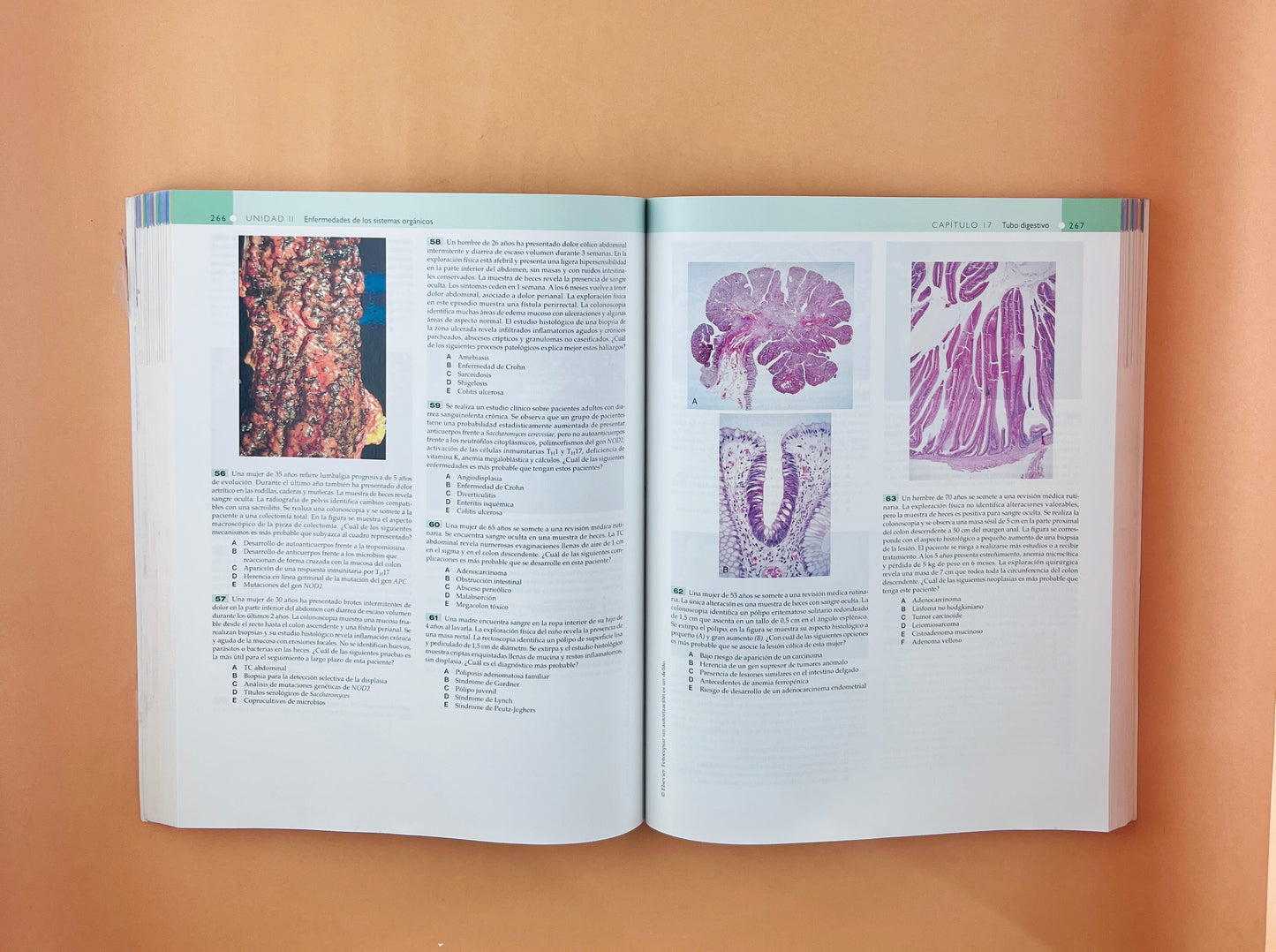 Robbins y Cotran repaso de anatomía patológica preguntas y respuestas cuarta edición