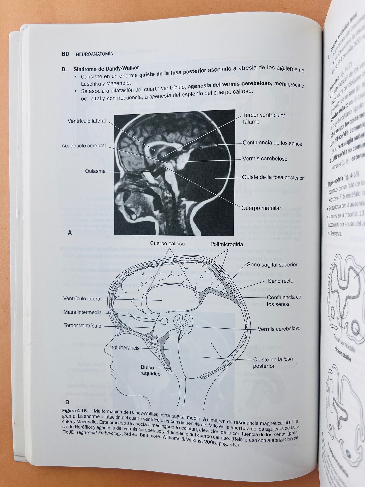 Temas clave neuroanatomía cuarta edición