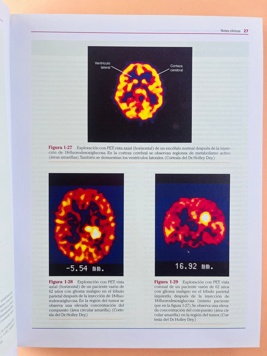 Neuroanatomía Clínica 7a edición by Richard S. Snell