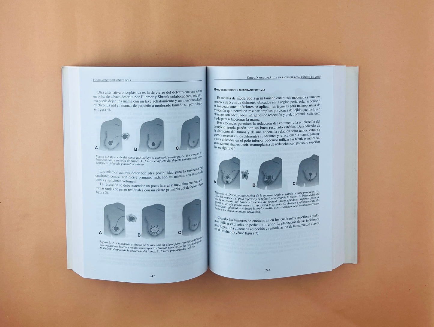 Fundamentos de oncología