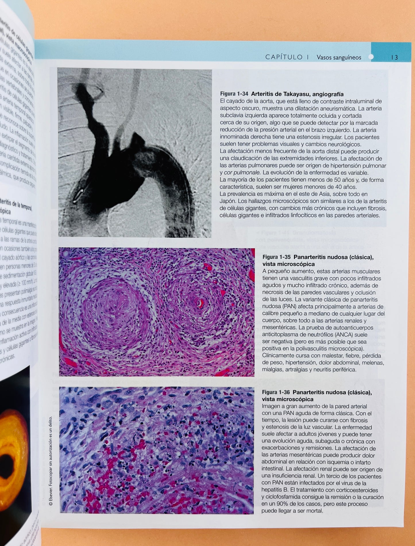 Robbins y Cotran Atlas de Anatomía Patológica tercera edición