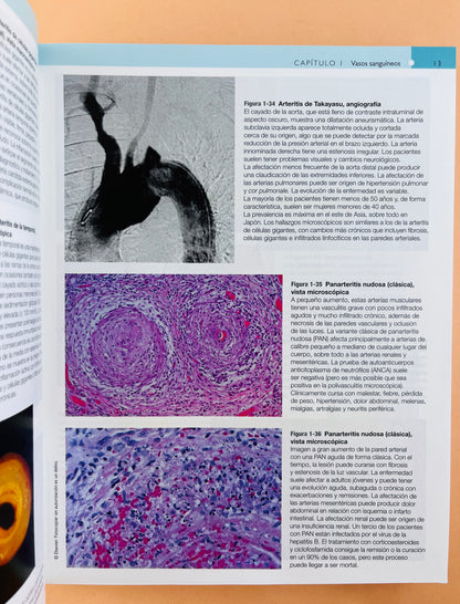 Robbins y Cotran Atlas de Anatomía Patológica tercera edición