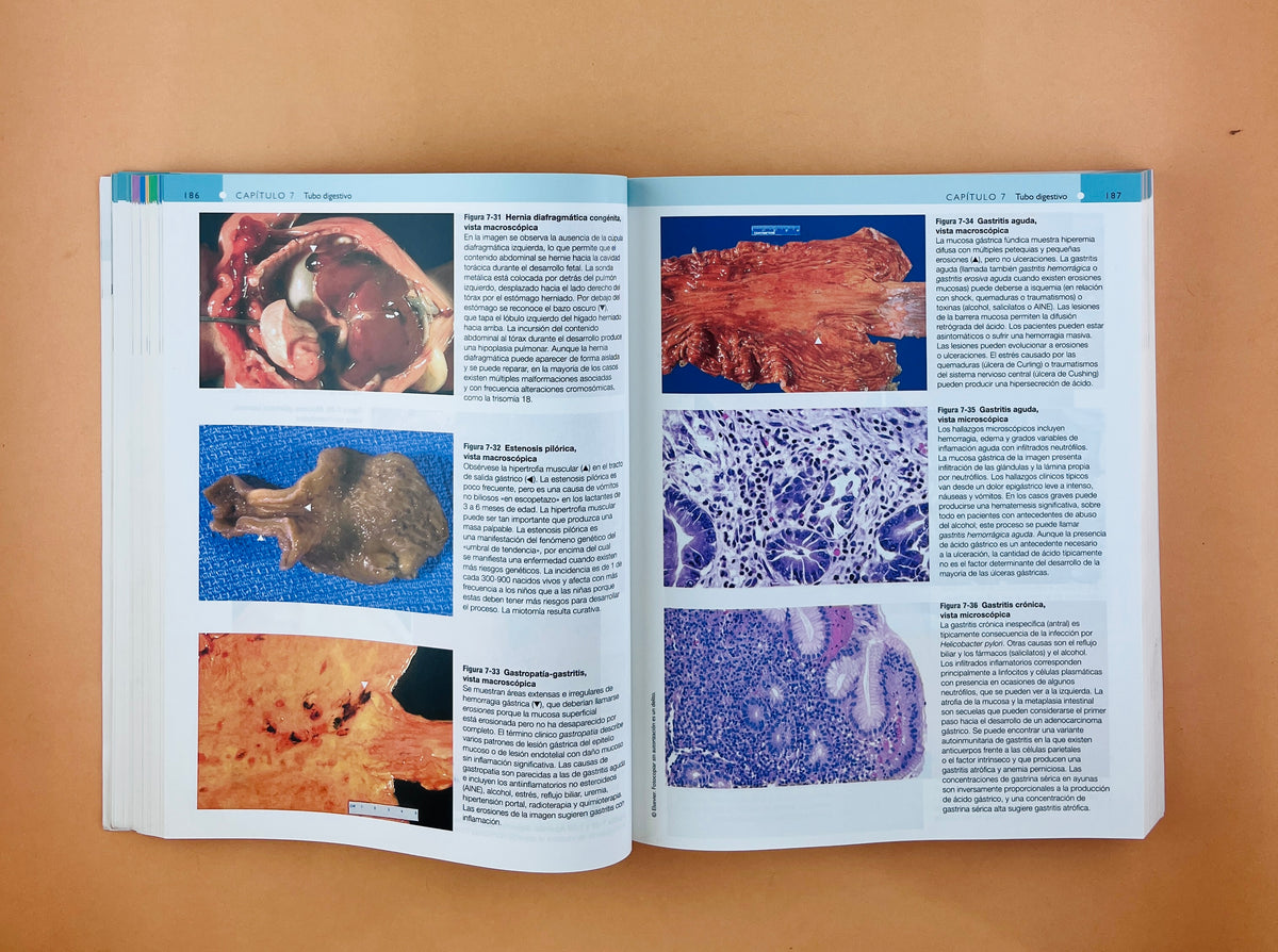 Robbins y Cotran Atlas de Anatomía Patológica tercera edición by Edward C. klatt