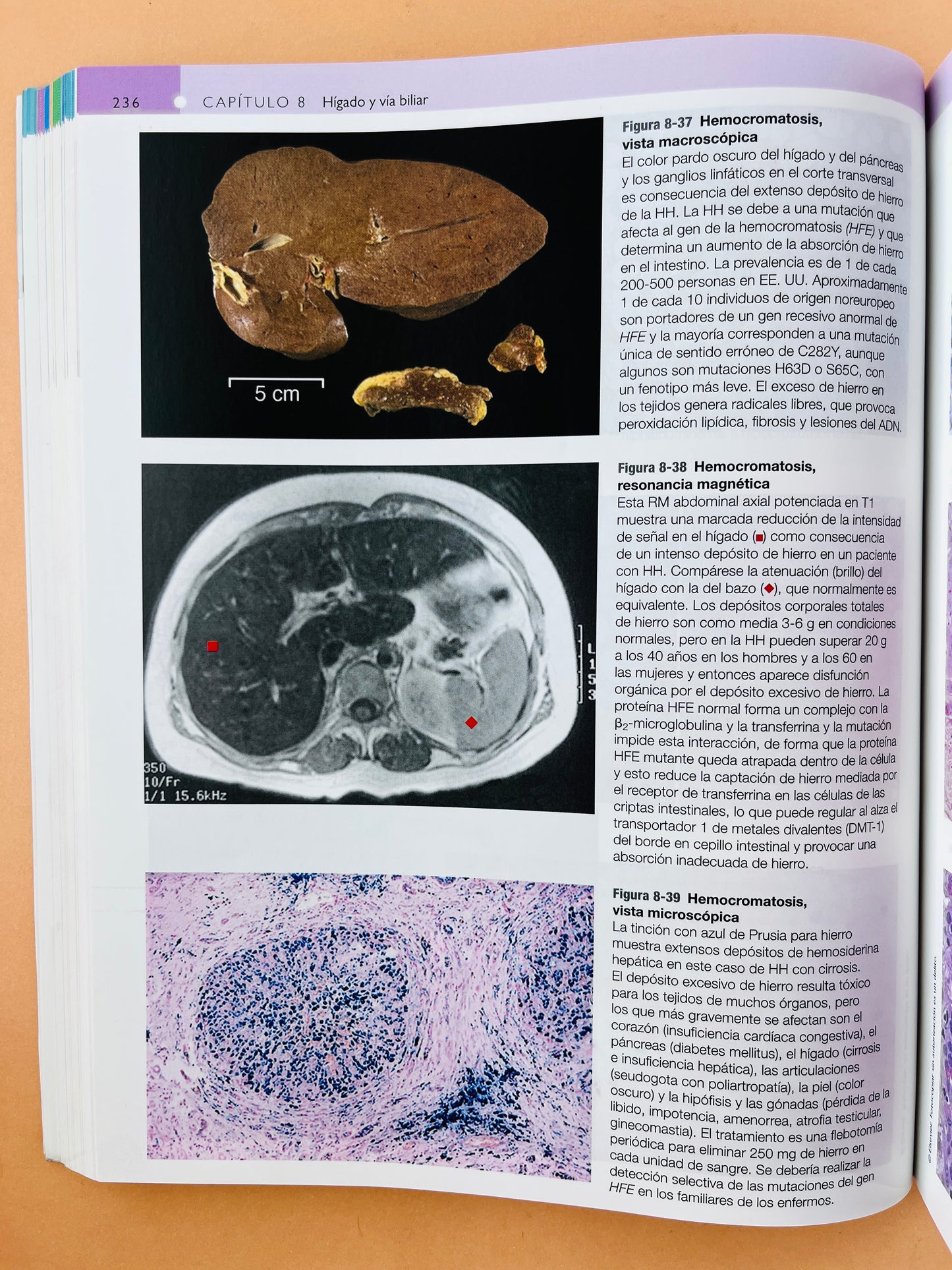 Robbins y Cotran Atlas de Anatomía Patológica tercera edición