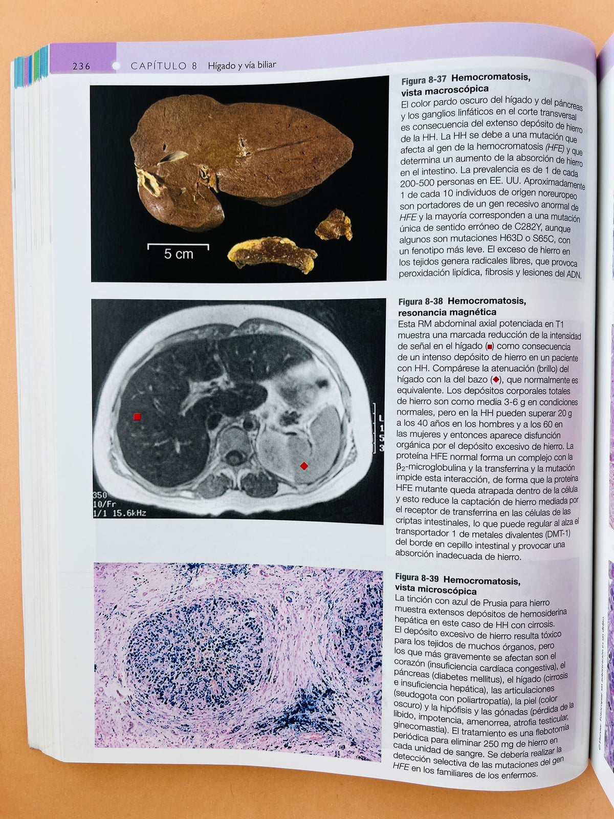 Robbins y Cotran Atlas de Anatomía Patológica tercera edición by Edward C. klatt