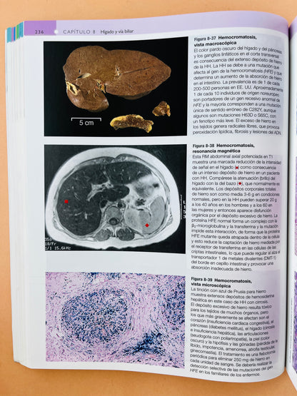 Robbins y Cotran Atlas de Anatomía Patológica tercera edición