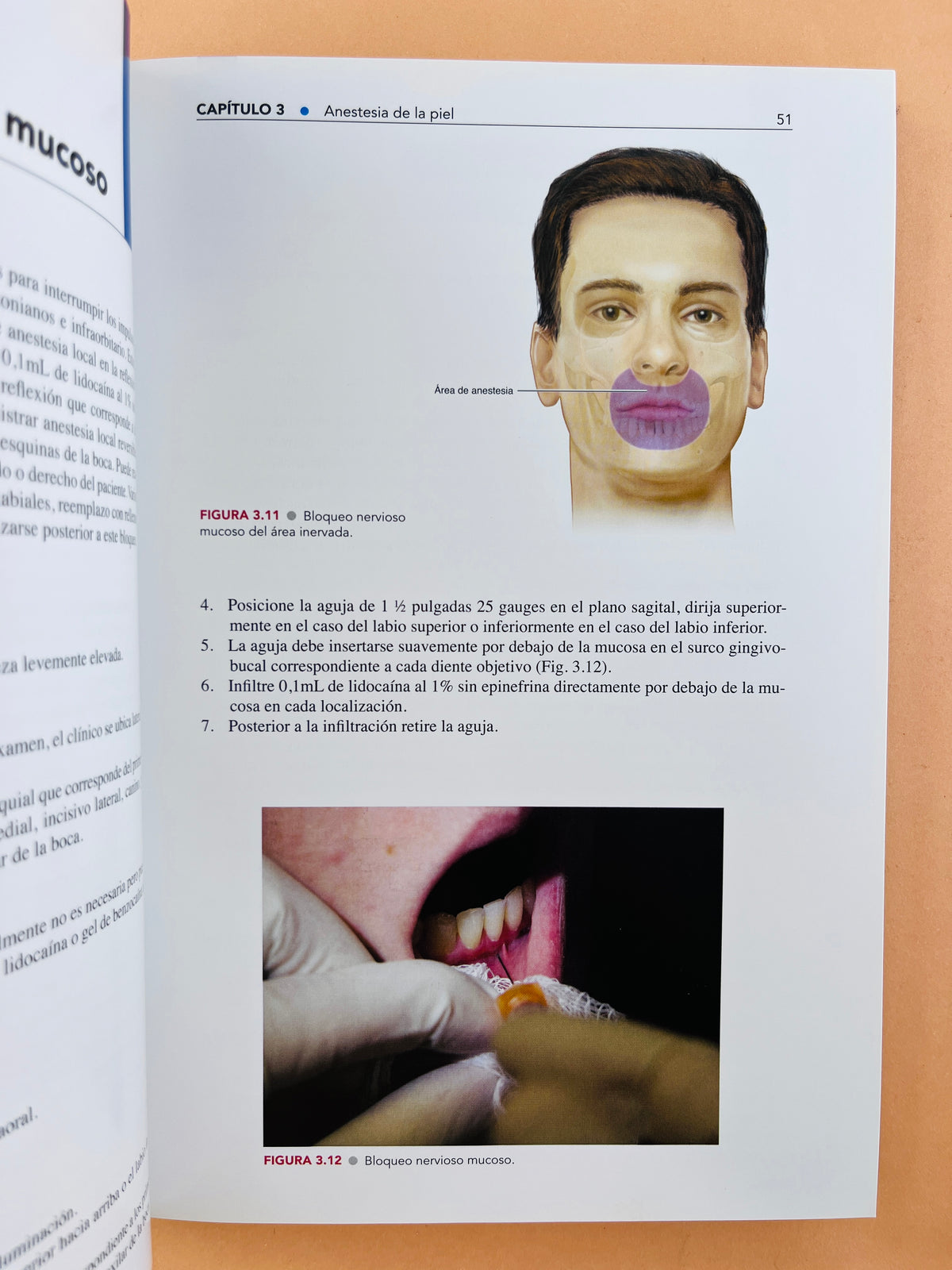 Guía práctica Infiltraciones Articulares y de tejido blando tercera edición by James W. McNabb