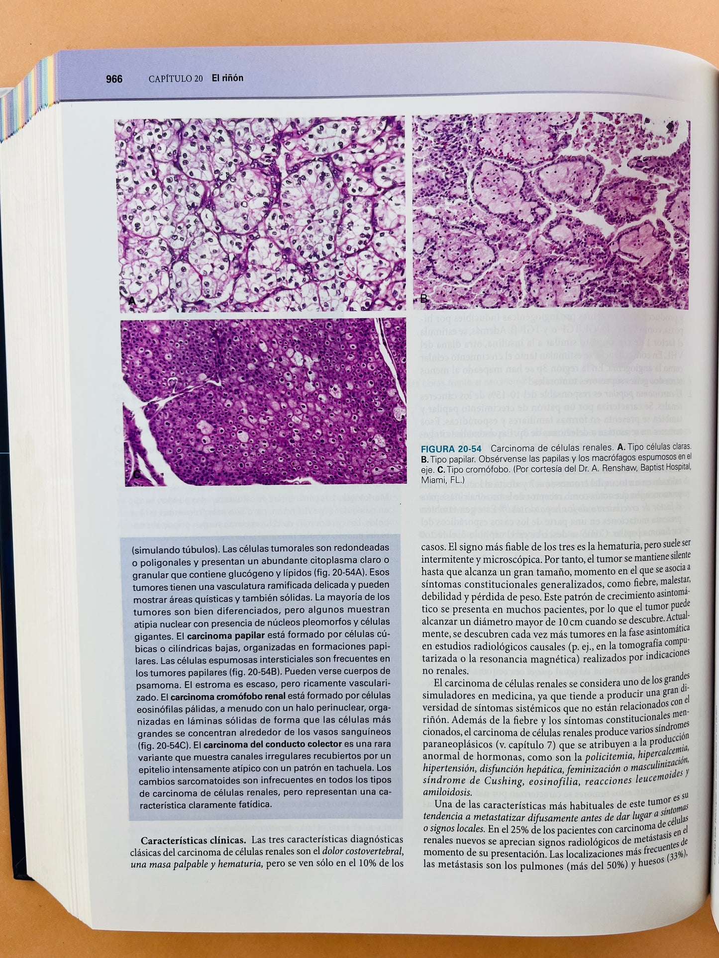 Robbins y Cotran Patología estructural y funcional Octava edición