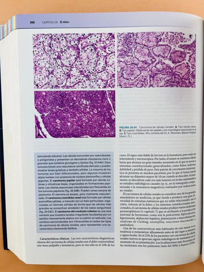 Robbins y Cotran Patología estructural y funcional Octava edición
