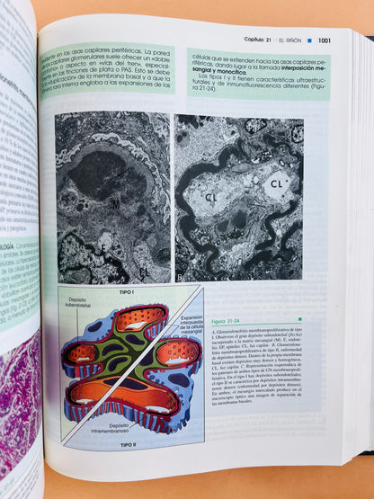 Robbins Patología estructural y funcional sexta edición