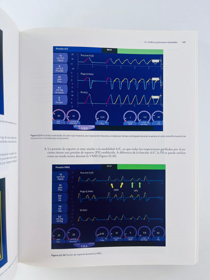 Manual de asistencia respiratoria en Neonatología cuarta edición
