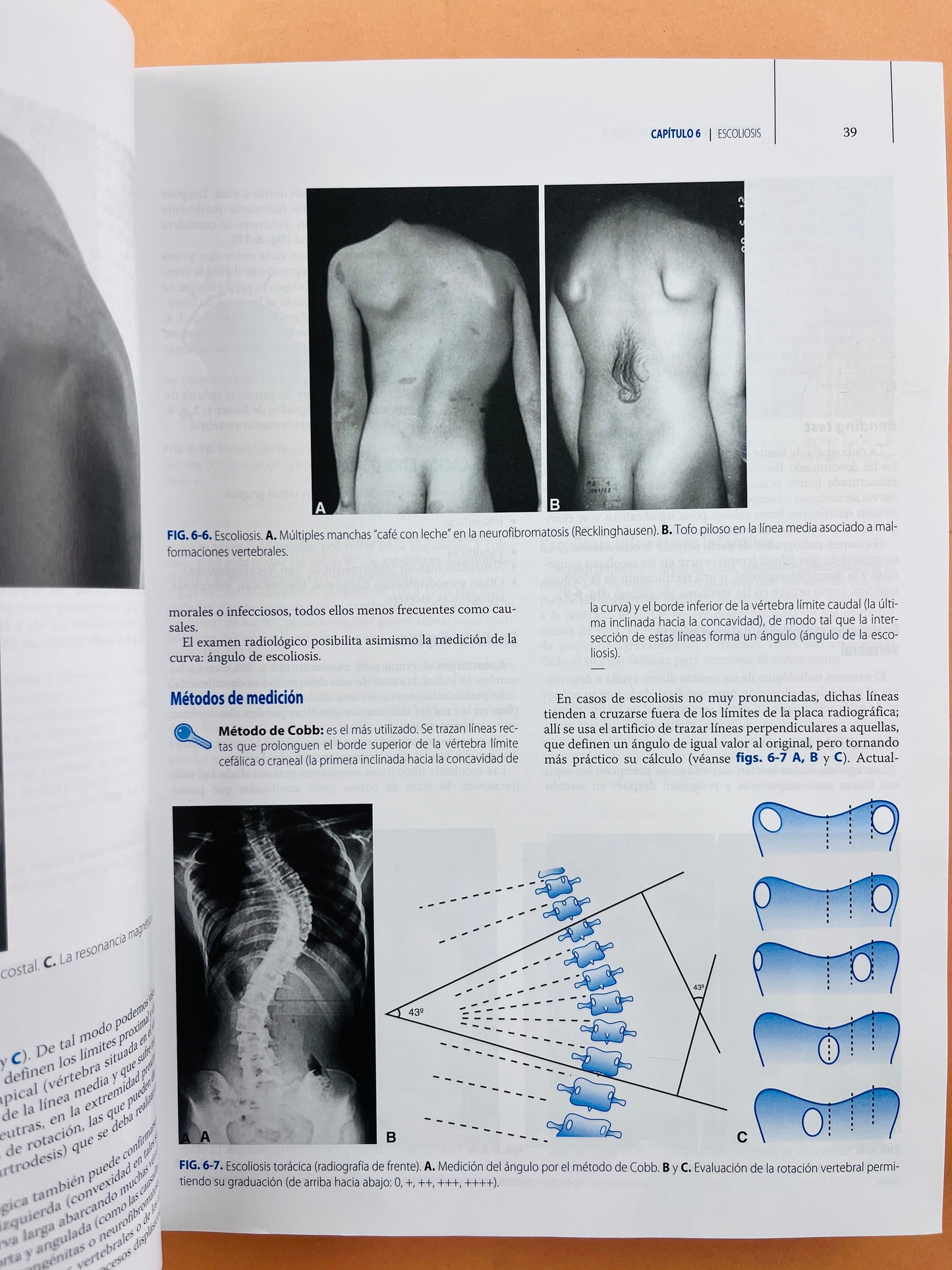 Ortopedia y Traumatología cuarta edición