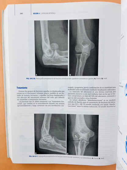 Ortopedia y Traumatología cuarta edición