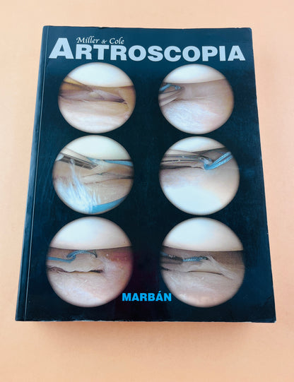Artroscopia