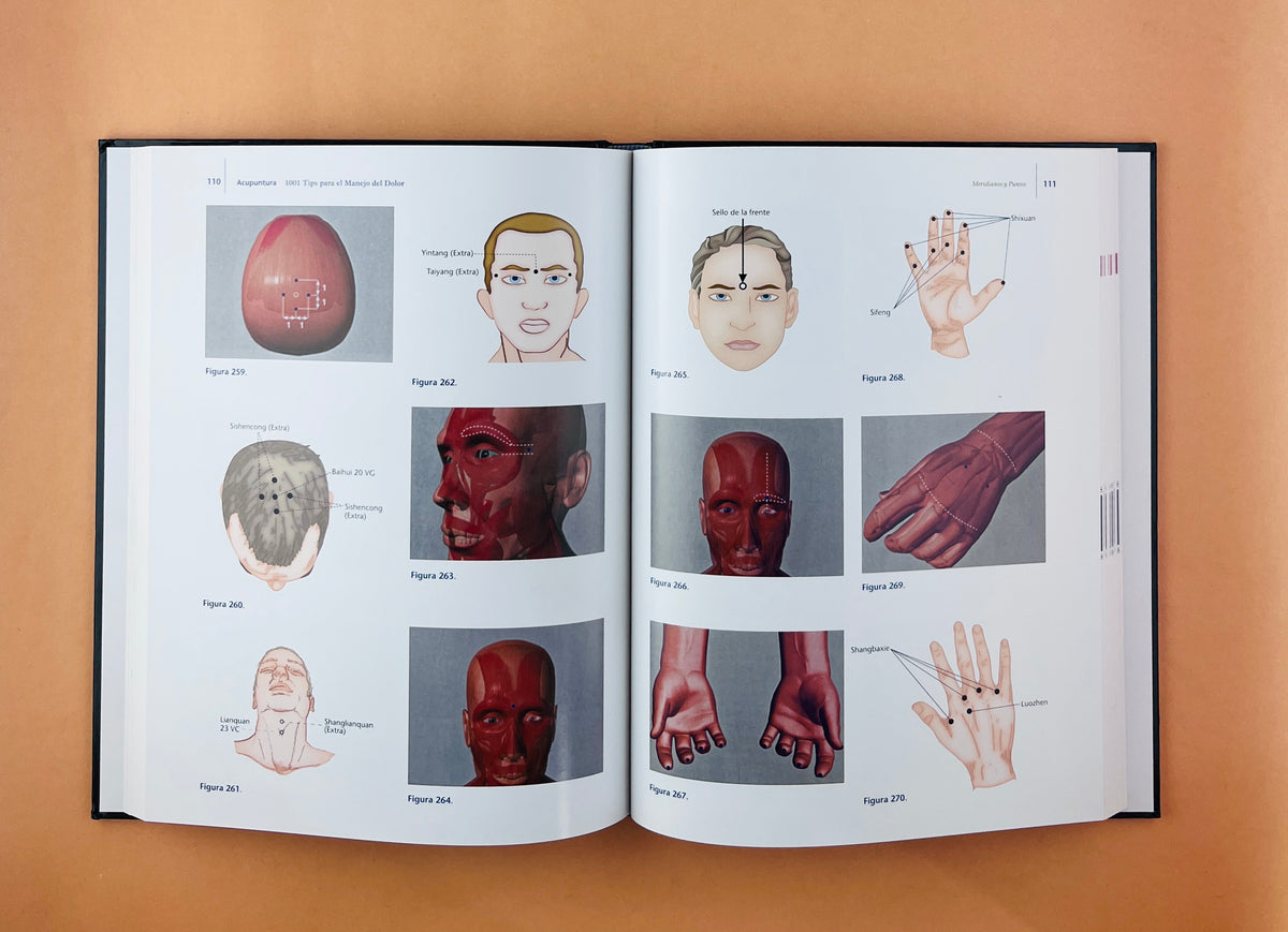 Acupuntura 1001 Tips para el manejo del dolor segunada edición by Luis A. Urgelles