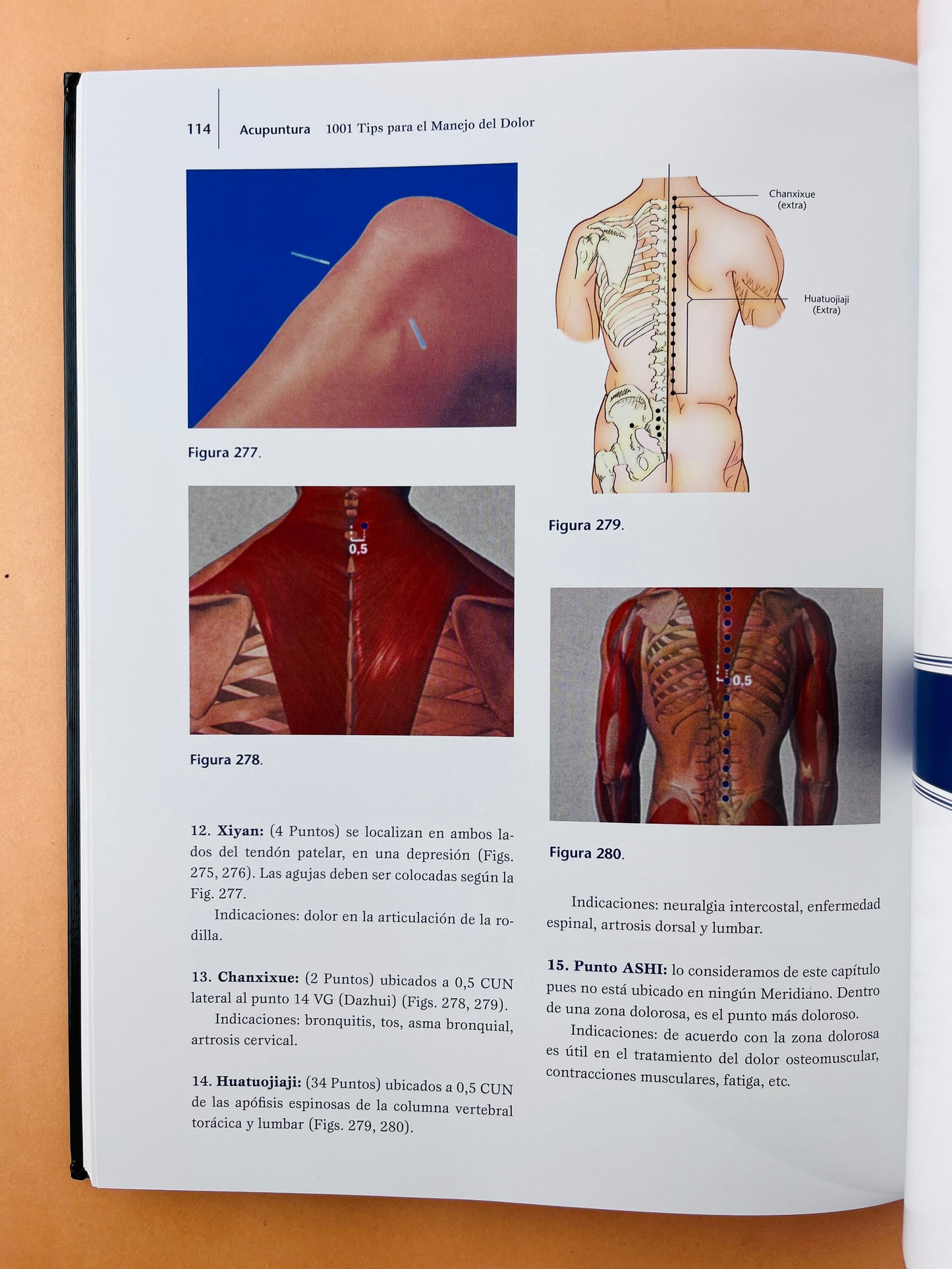 Acupuntura 1001 Tips para el manejo del dolor segunada edición
