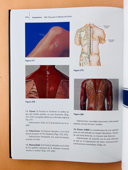 Acupuntura 1001 Tips para el manejo del dolor segunada edición