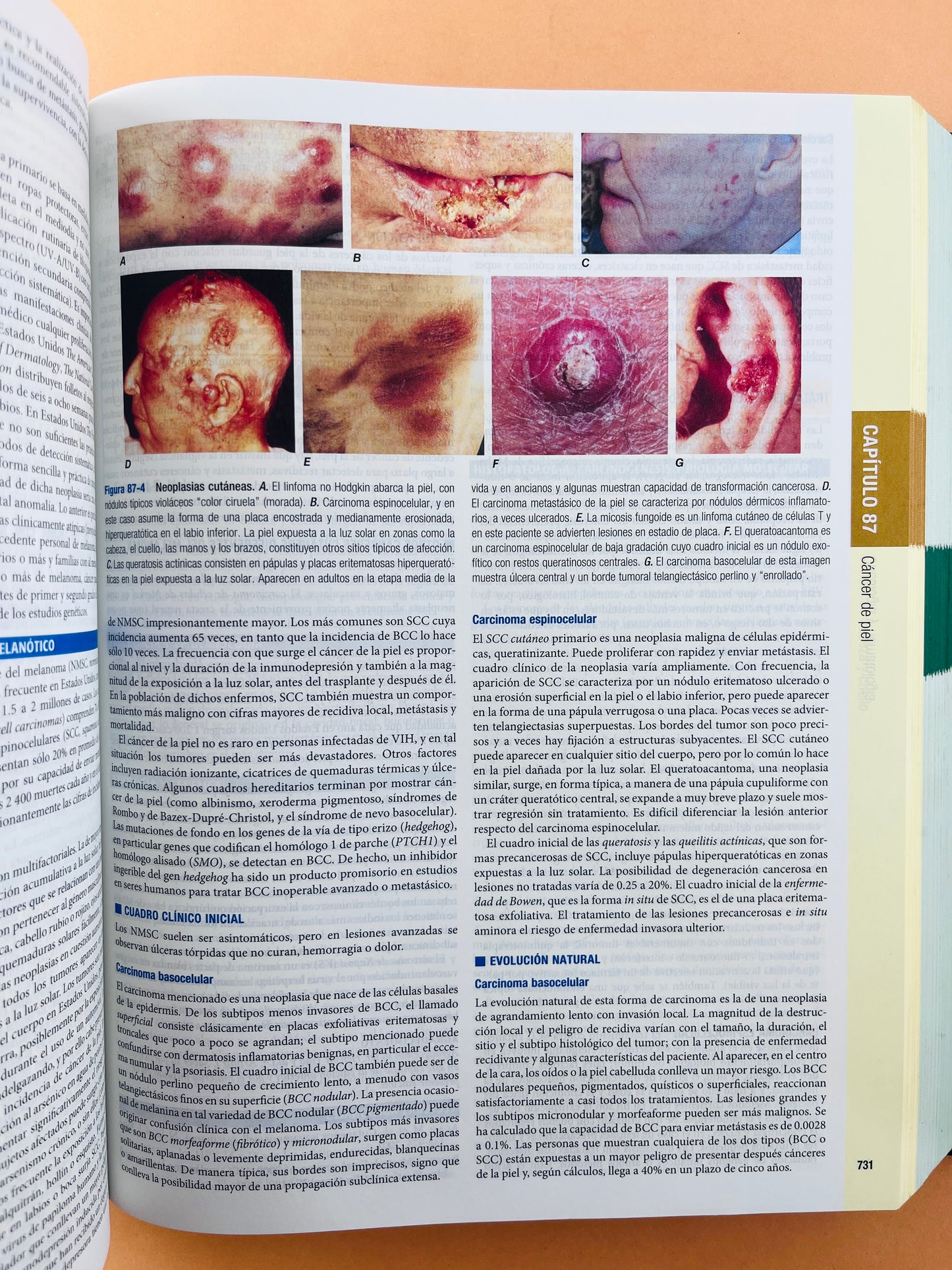 Harrison principios de Medicina Interna edición 18a 2 volúmenes
