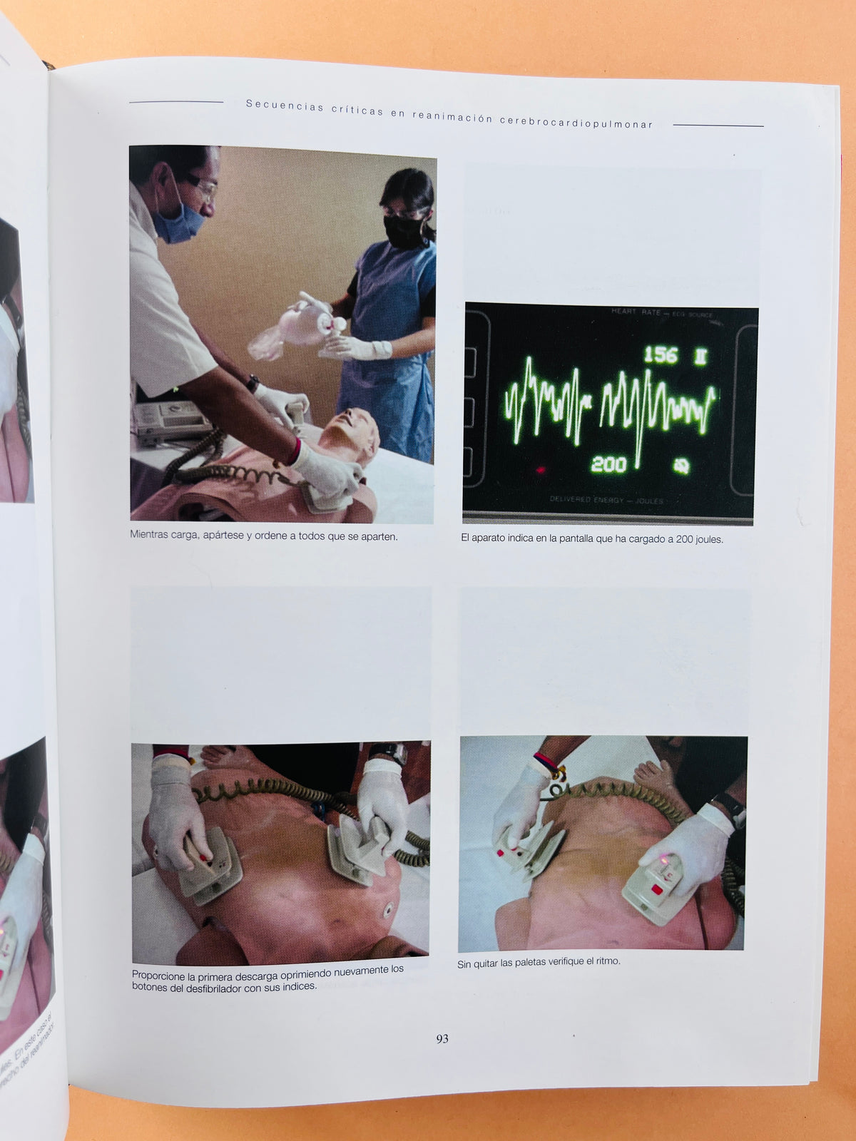 Reanimación Cerebrocardiopumonar asuntos críticos by Laureano Quintwero B.
