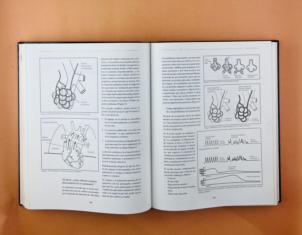 Reanimación Cerebrocardiopumonar asuntos críticos by Laureano Quintwero B.