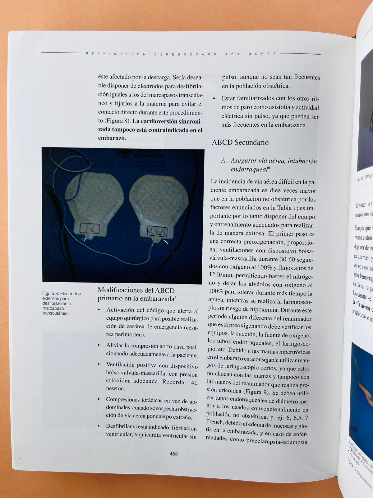 Reanimación Cerebrocardiopumonar asuntos críticos by Laureano Quintwero B.